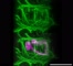 [thumbnail of Movie 6.2 3D 24hpi_infected_actin 9fps.avi]