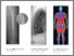 [thumbnail of Ralston_et_al-2019-Journal_of_Bone_and_Mineral_Research]