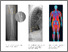 [thumbnail of Carswell_etal_2023_JBoneMineralRes]
